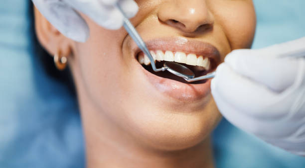 Best Emergency Wisdom Teeth Removal in Clarinda, IA